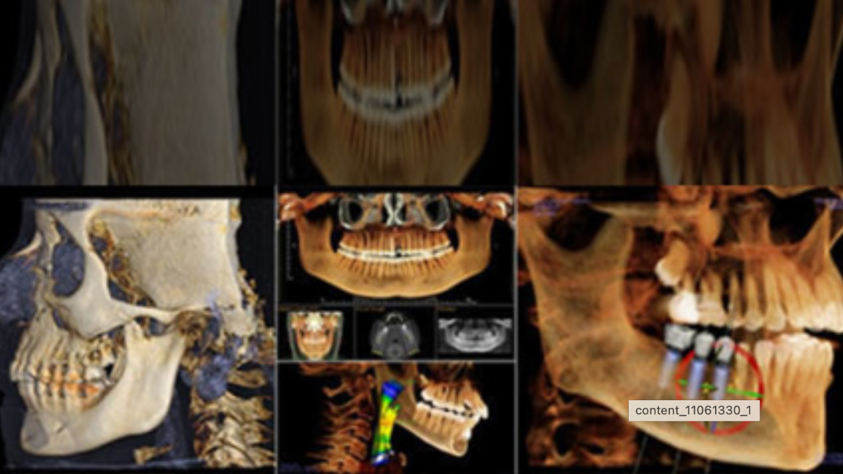 Oral et Maxillofacial Mini résidence à UCSD en Français