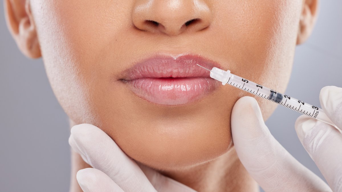 Niveau IV - Cours d'injection d'agents de comblement